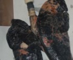 Рак легких (рак легкого)