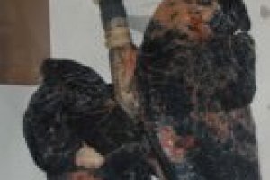 Рак легких (рак легкого)